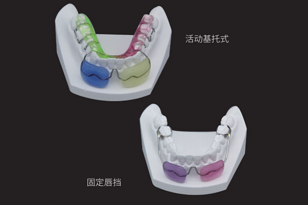 唇擋矯治器